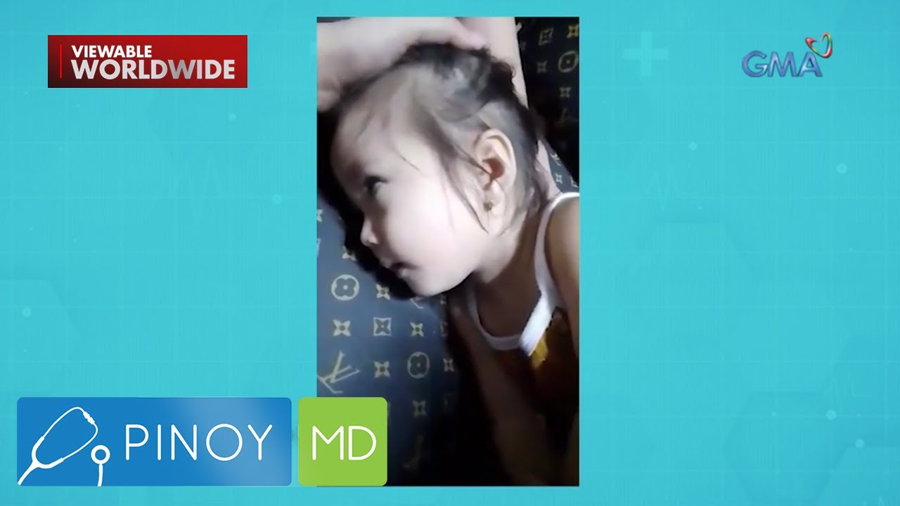 Seizure attacks sa mga bata, ano ang dahilan?  | Pinoy MD