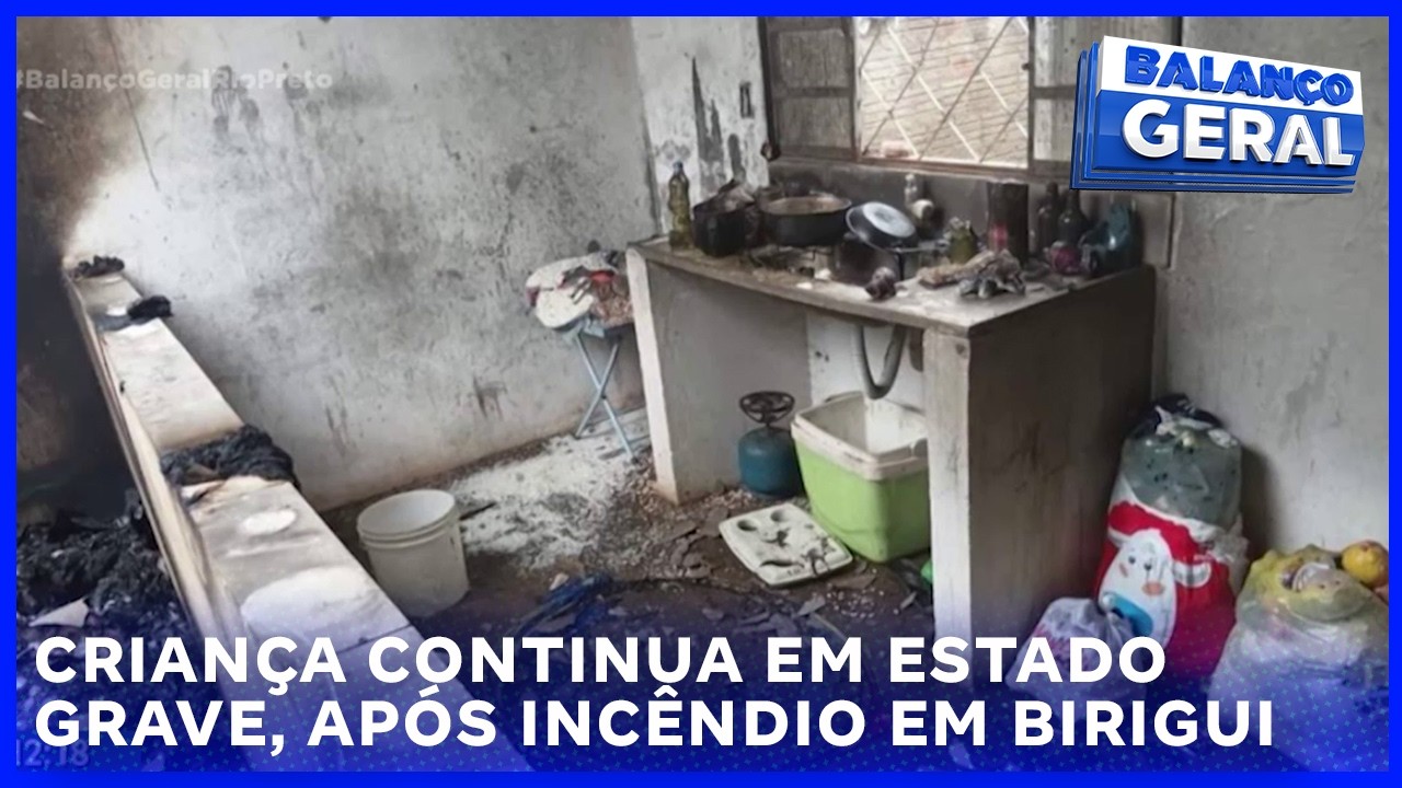 Criança continua em estado grave, após incêndio em Birigui