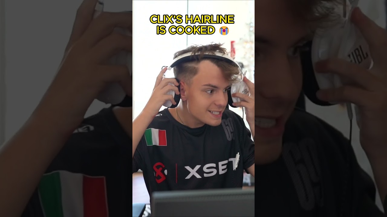 Clix's hairline is DONE 😭