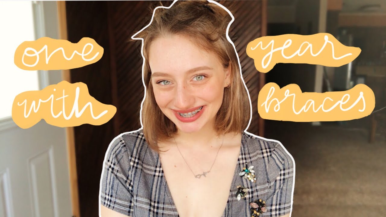 Adult Braces ONE YEAR UPDATE // rubber bands, bite plate, closing loop