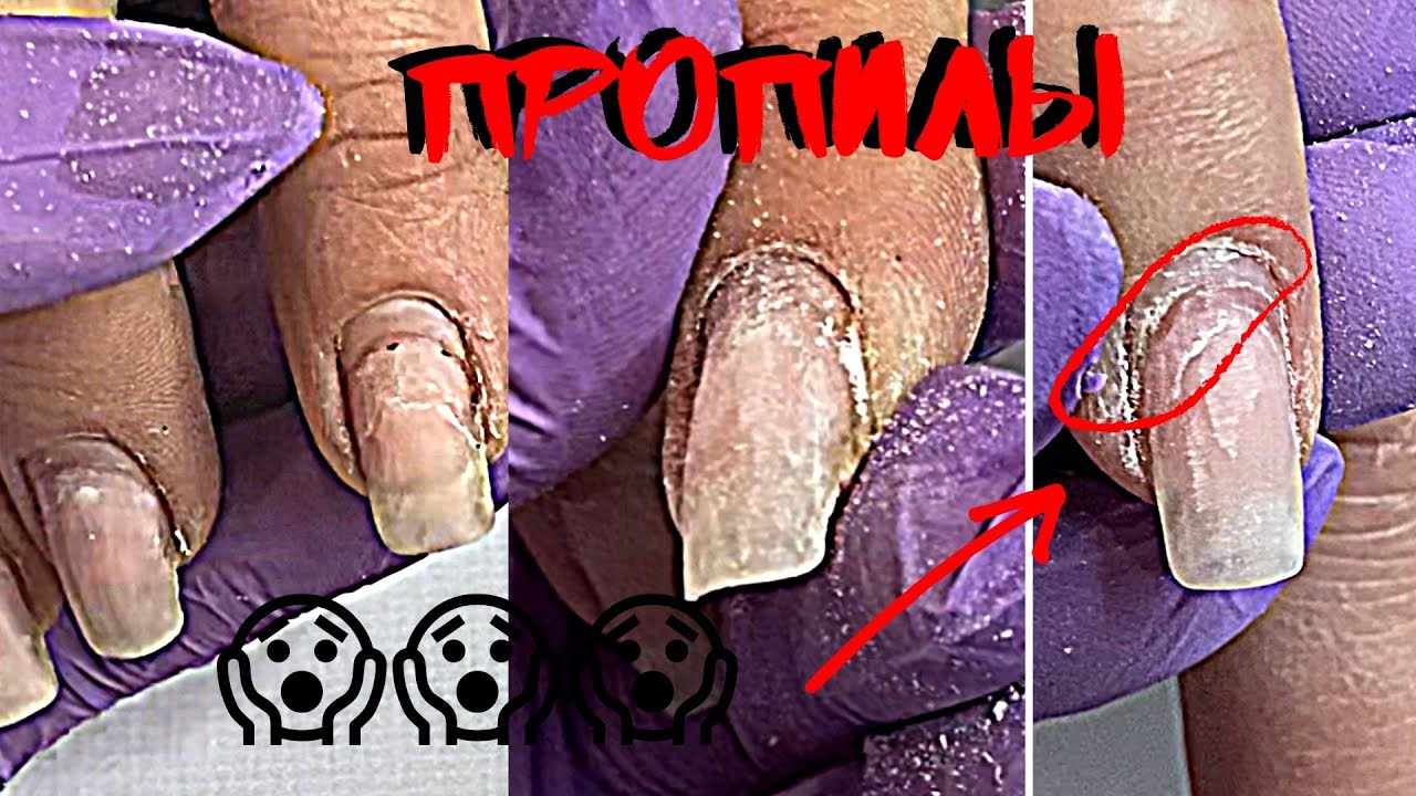 ТАК НЕ ХОТЕЛА ЕГО ДЕЛАТЬ🤦🏻‍♀️|Мне было очень сложно и долго |ТОЧЕК ВРОСТА НЕТ СОВСЕМ🤷🏻‍♀️