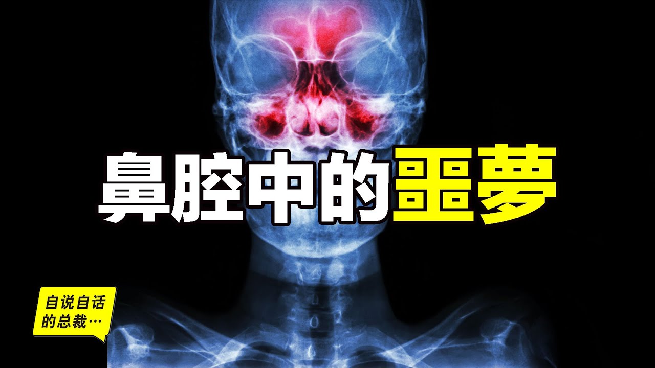 當你爆發過敏性鼻炎時，這就是你體內發生的故事……|自說自話的總裁