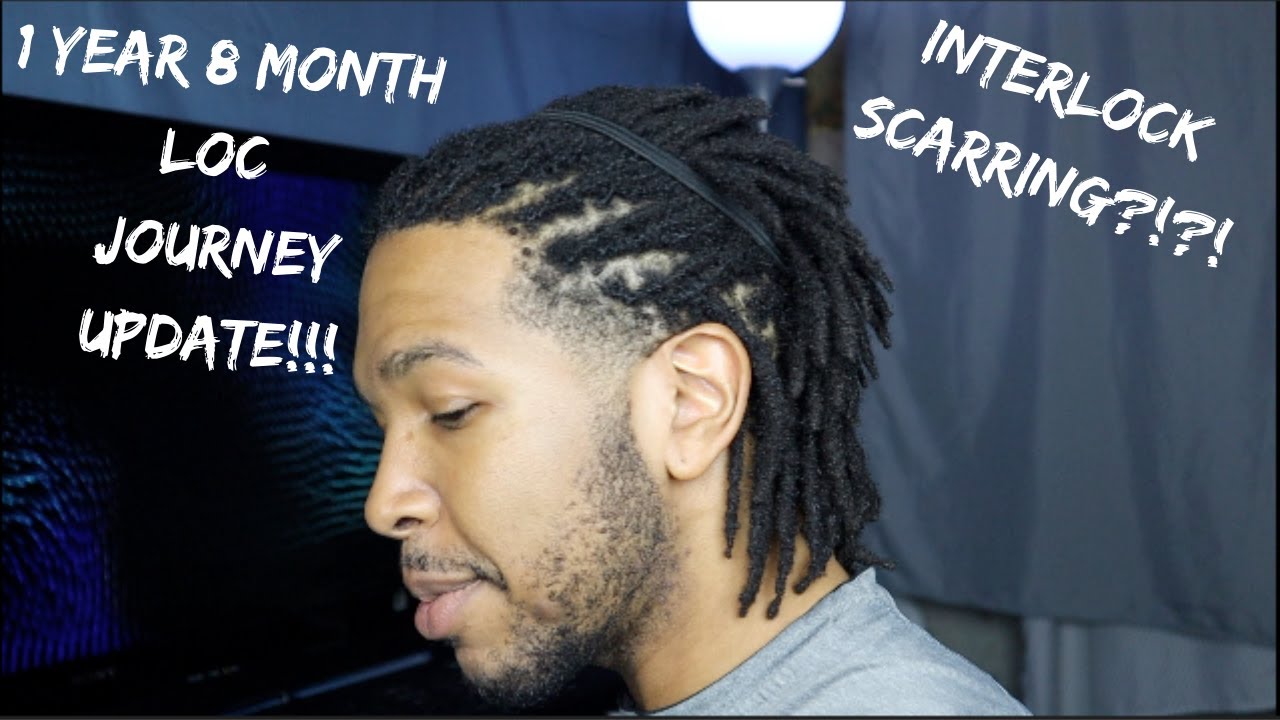 1 Year 8 Month Loc Journey Update!!! ***INTERLOCK SCARRING***#johnnylox#locjourney