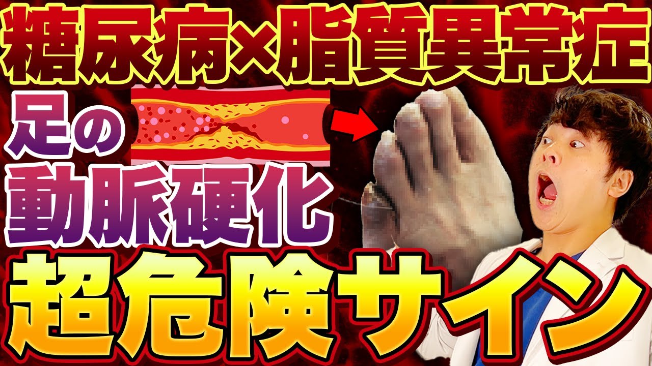 【意外すぎる...】糖尿病→動脈硬化！足に出てくる危険サイン【現役糖尿病内科医】