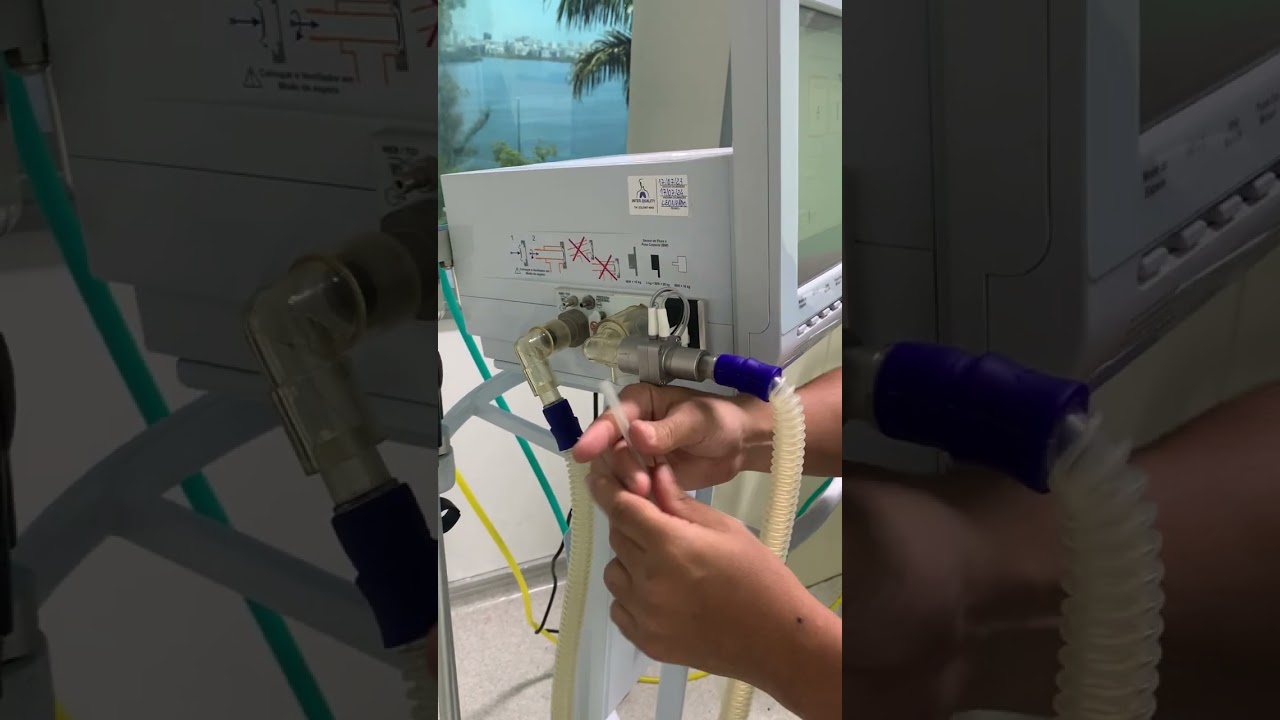 Breve treinamento - Ventilador pulmonar IX5 - Vyaire Intermed