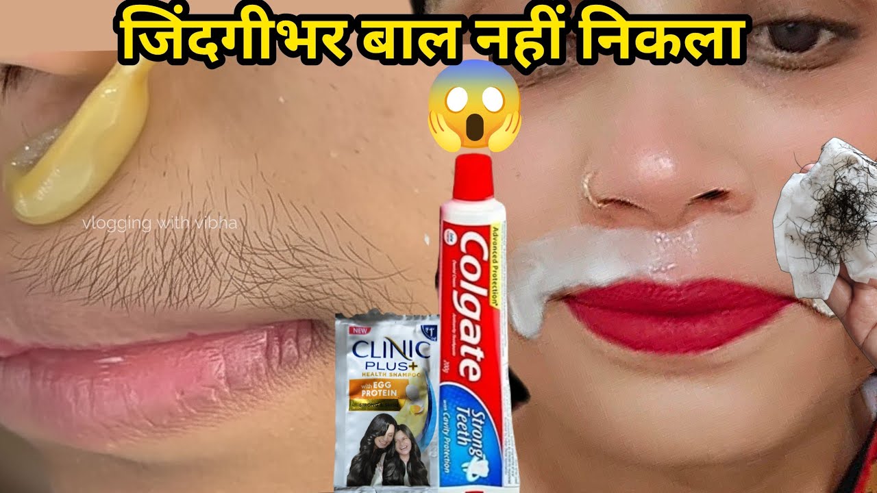 डॉक्टर ने बताया Vaseline से बिना दर्द चेहरे के बाल निकालने का आसान तरीका😱|| Facial Hair Removal