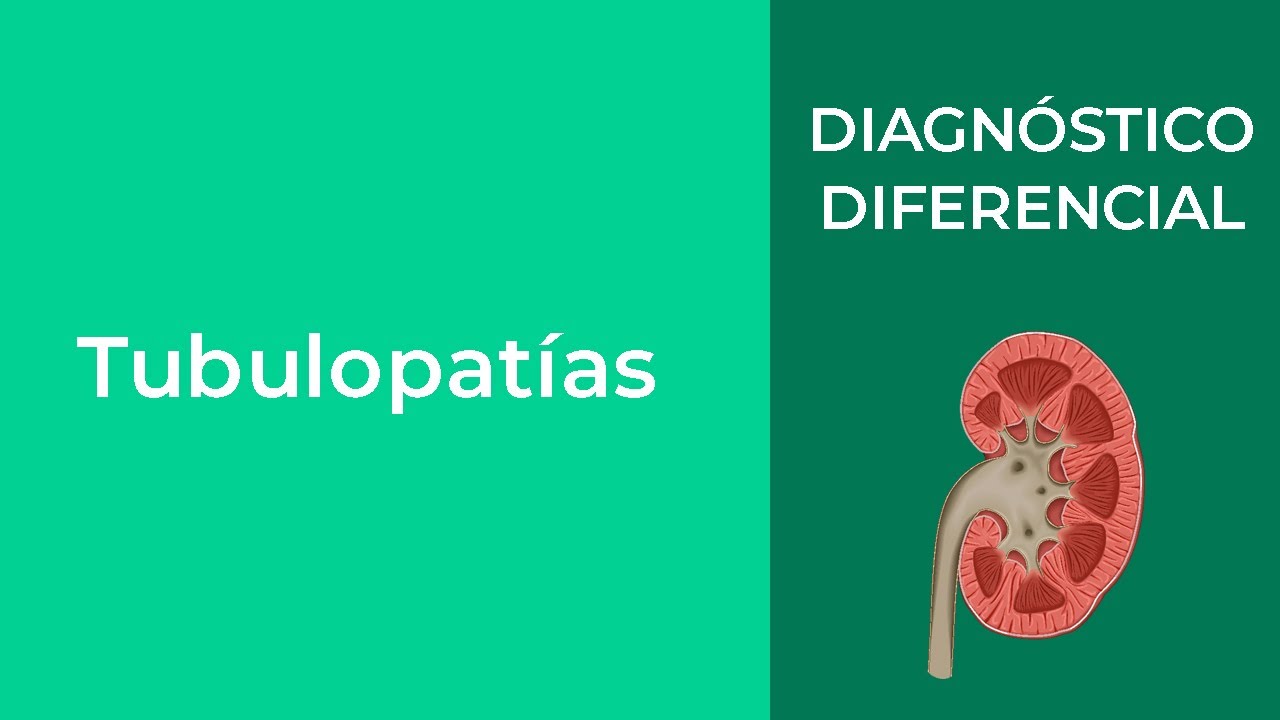 Diagnóstico Diferencial. Tubulopatías