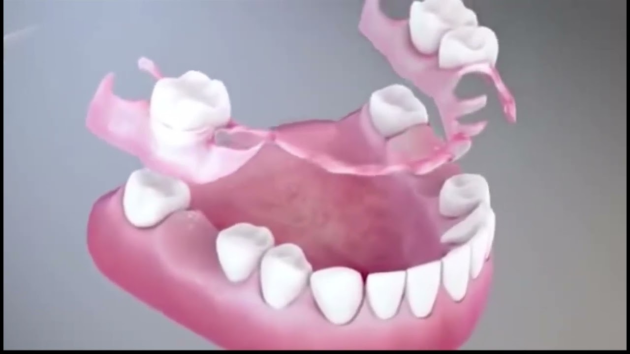 Dentaduras