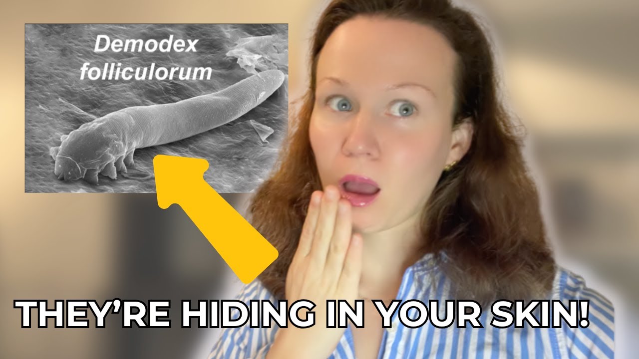 The Secret Life of Face Mites &ndash; What Demodex Are Doing on Your Skin?