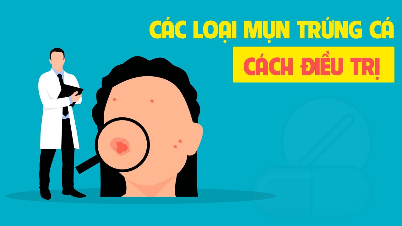 Các loại mụn trứng cá và cách điều trị