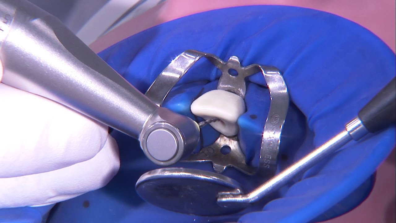 Endodontie - Partie 1
