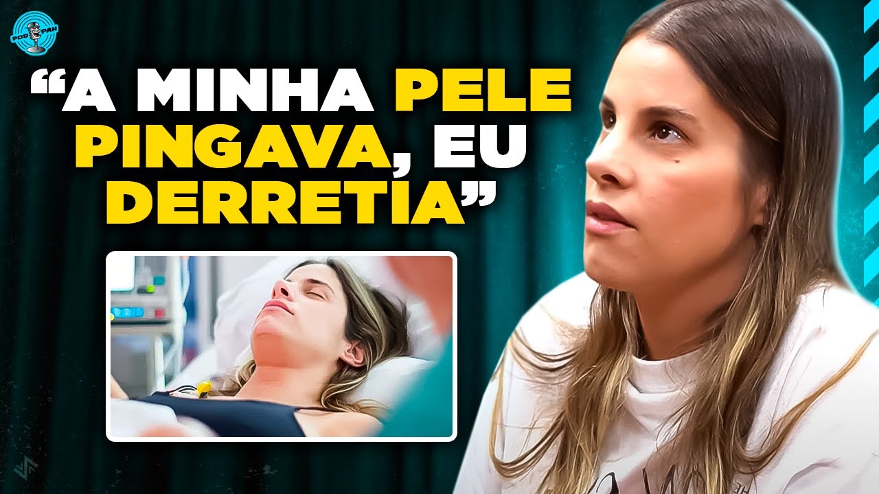 SHANTAL SOFREU ACIDENTE COM QUEIMADURAS GRAVES