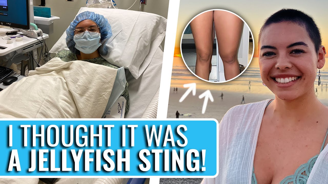 My Health Had Been Declining For MONTHS! | McKenna's Patient Story