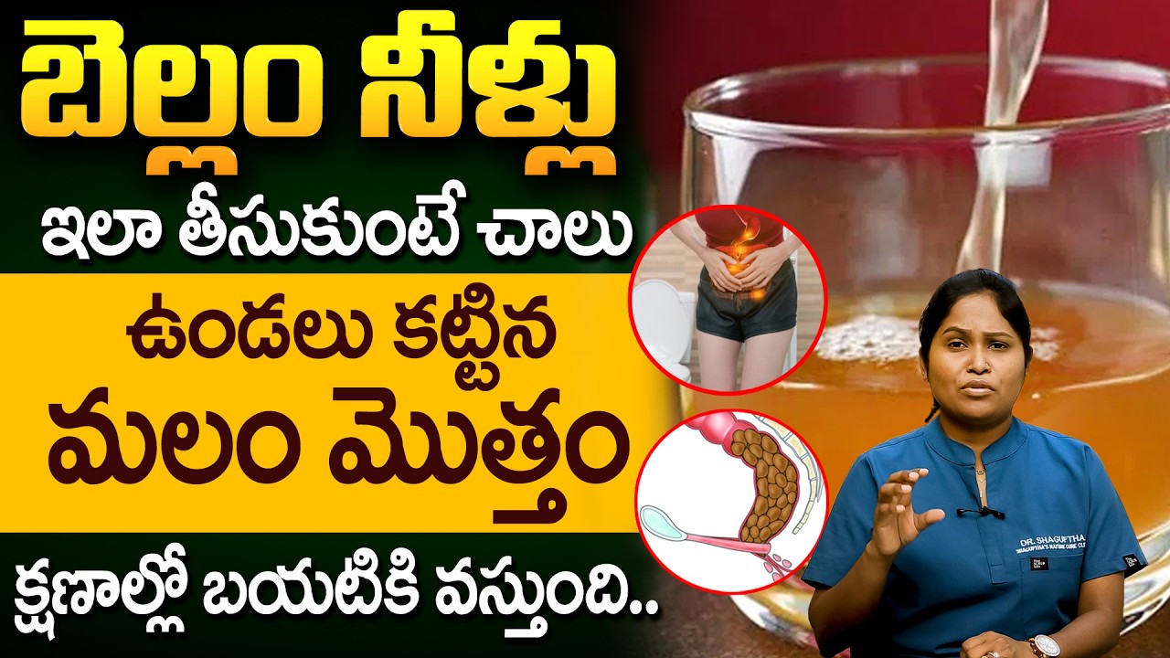 Dr Shaguftha - సగం గ్లాస్ తాగేలోపే మలం తన్నుకుంటూ బయటకి వచ్చేస్తుంది | Constipation | iD Health Care