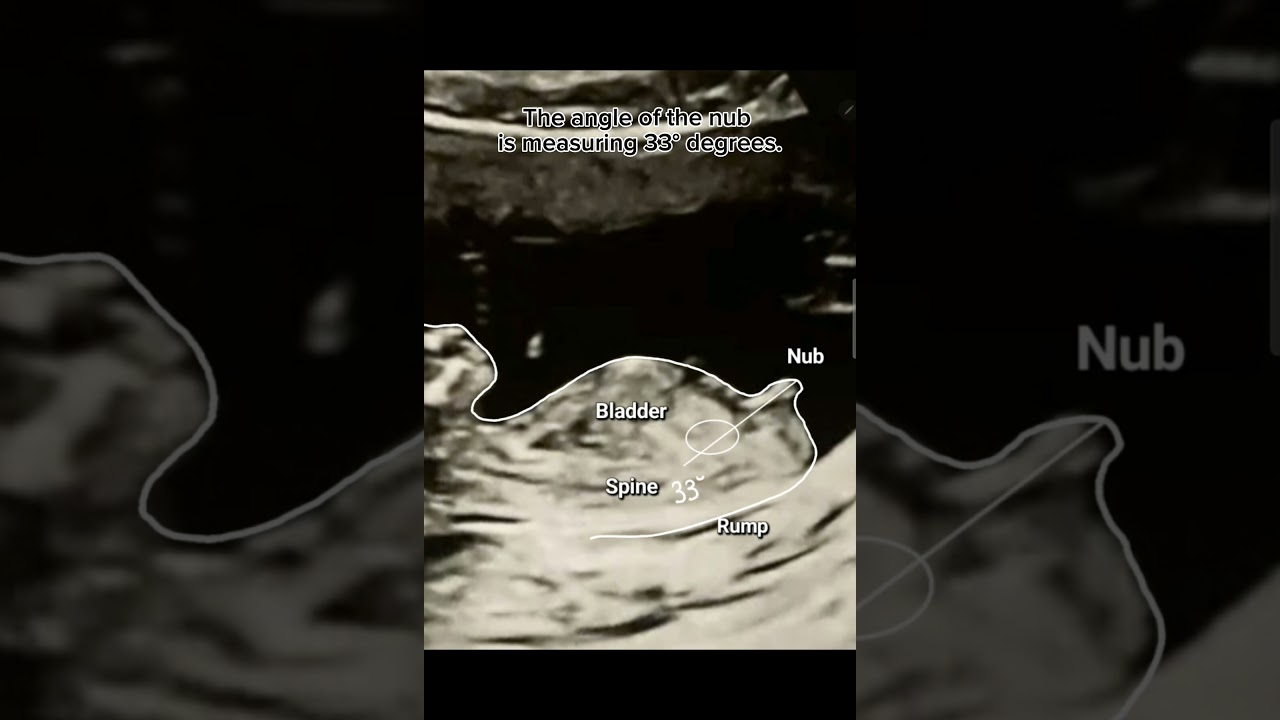 Nub theory: Gender reveal app name nubx