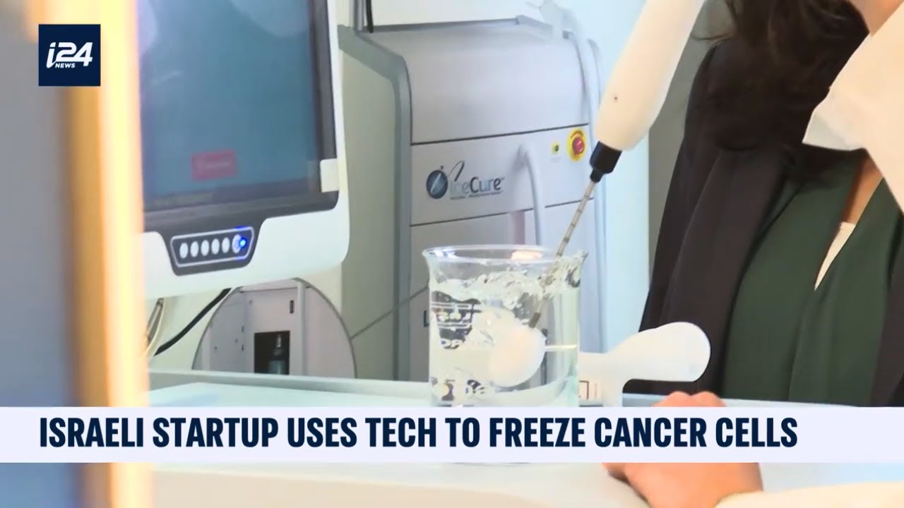 i24NEWS English Features IceCure Medical's ProSense Cryoablation System on World Cancer Day