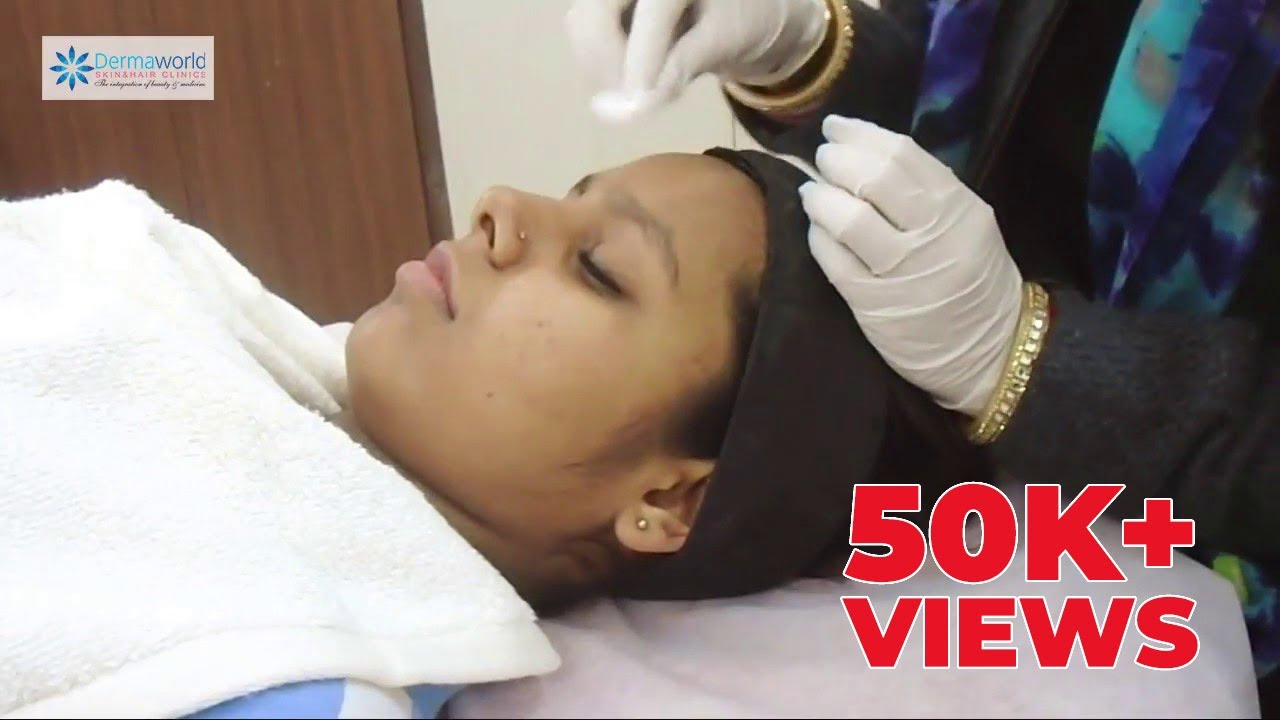 Step By Step Process For Salicylic Peel For Acne | Dermaworld Skin Clinics