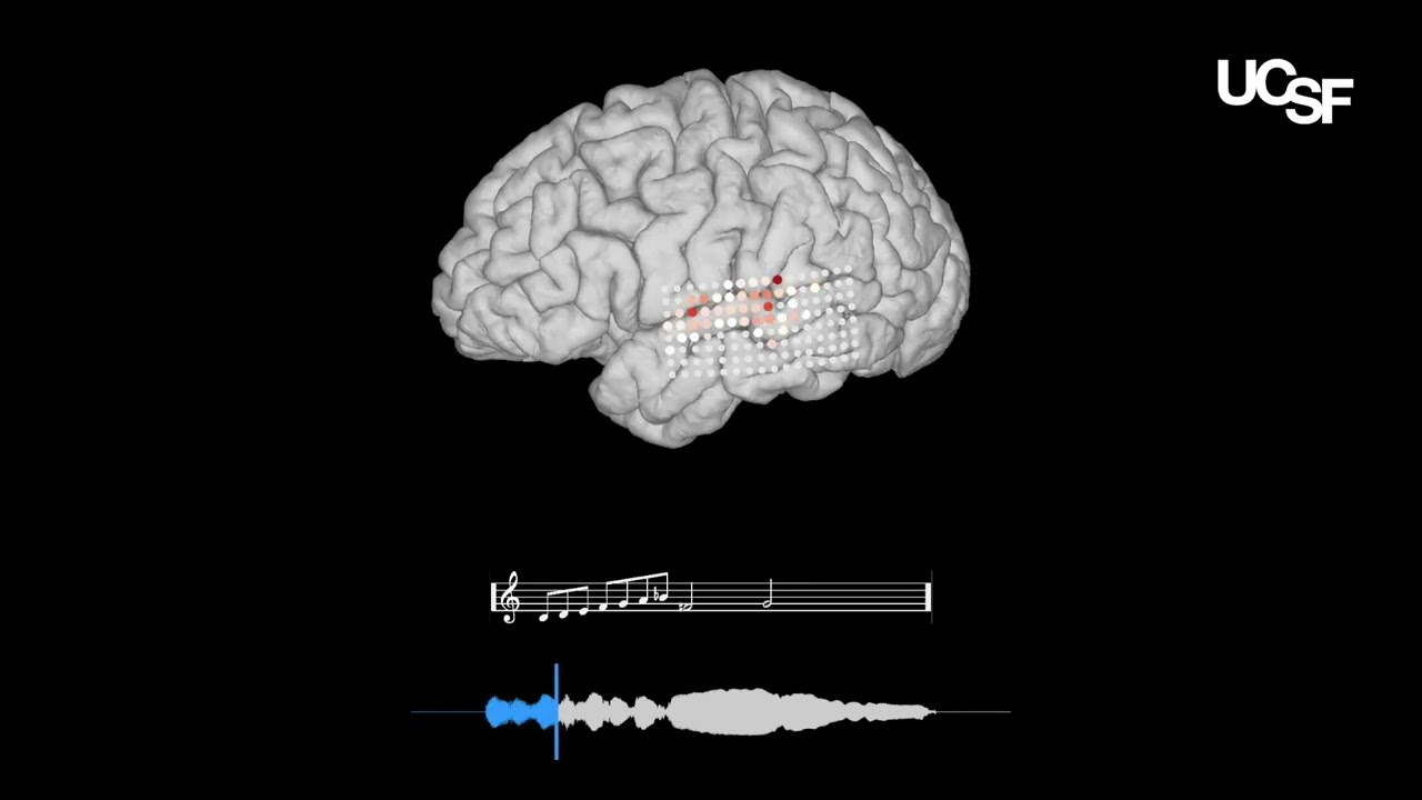 Encoding of melody in the human auditory cortex - Music Example | Chang Lab