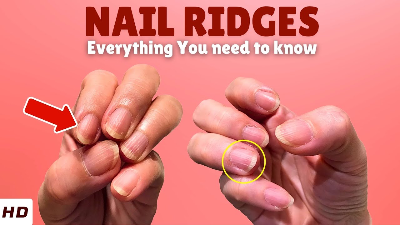 Nail Ridges: The Hidden Health Warning Signs Your Nails Are Trying to Tell You!