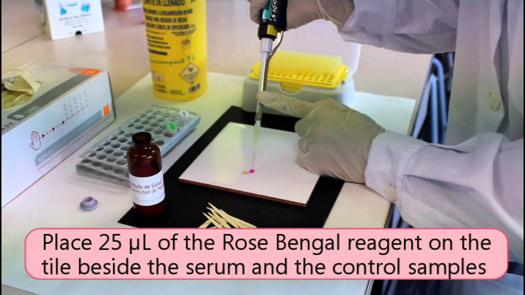 Rose bengal Test- diagnosis of brucellosis - ISTUN. Universidad de Navarra)