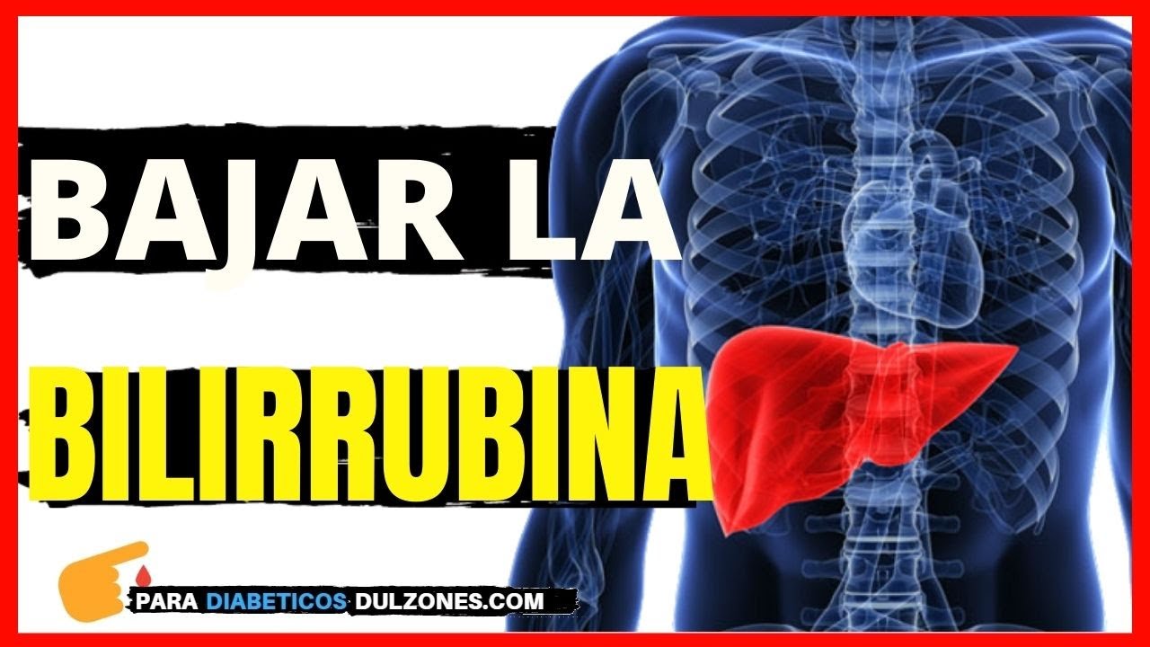 COMO BAJAR LA BILIRRUBINA- SIGUE ESTOS SIMPLES CONSEJOS
