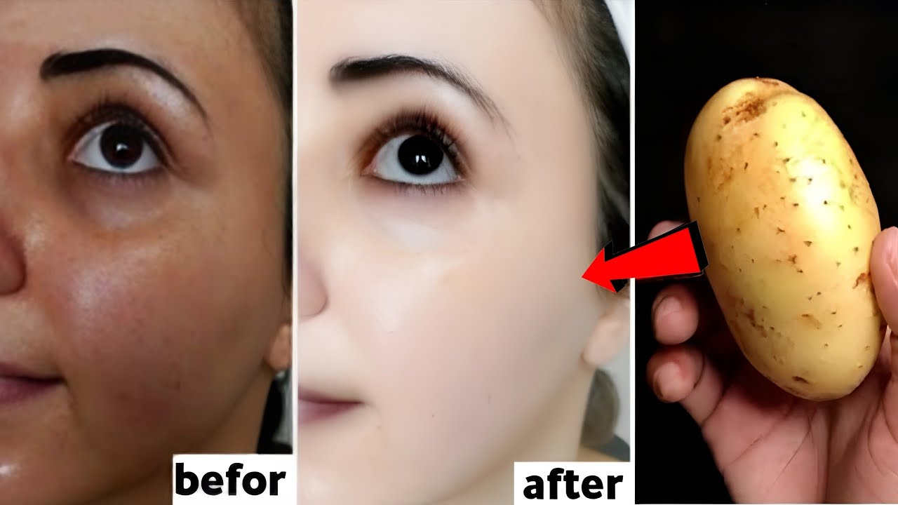 Japanese Secret To Whitening 10 Shades That Removes Wrinkles And Pigmentation For Snow White Skin
