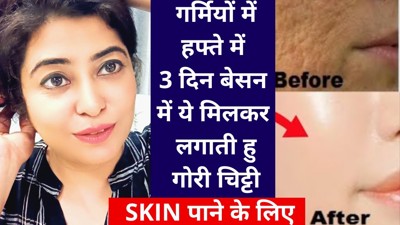 Summer Special- न महंगा ट्रीटमेंट,न कोई खर्चा गोरी चिट्टी स्किन पाने का ज़बरदस्त नुस्खा #fairskin