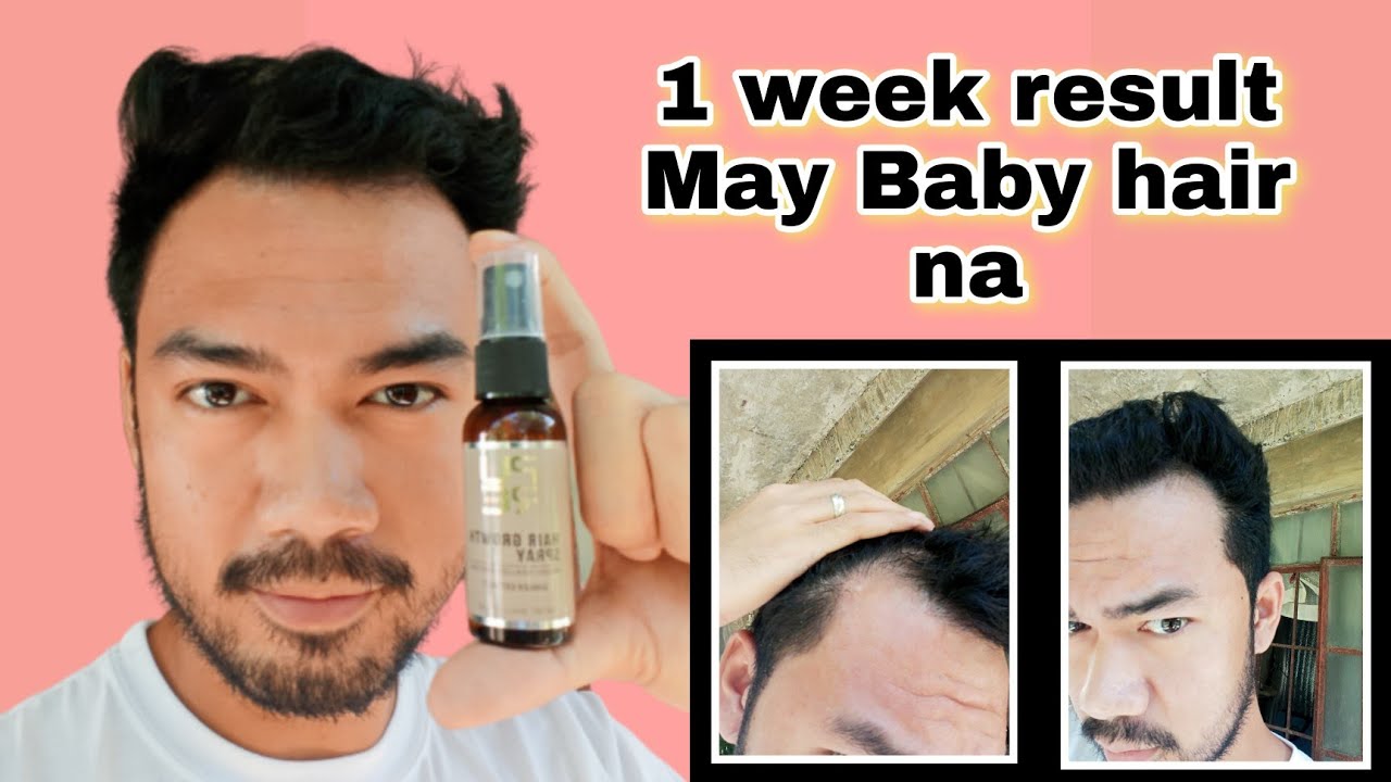 PURC HAIR GROWTH SPRAY First Week of Using May Baby na AGAD