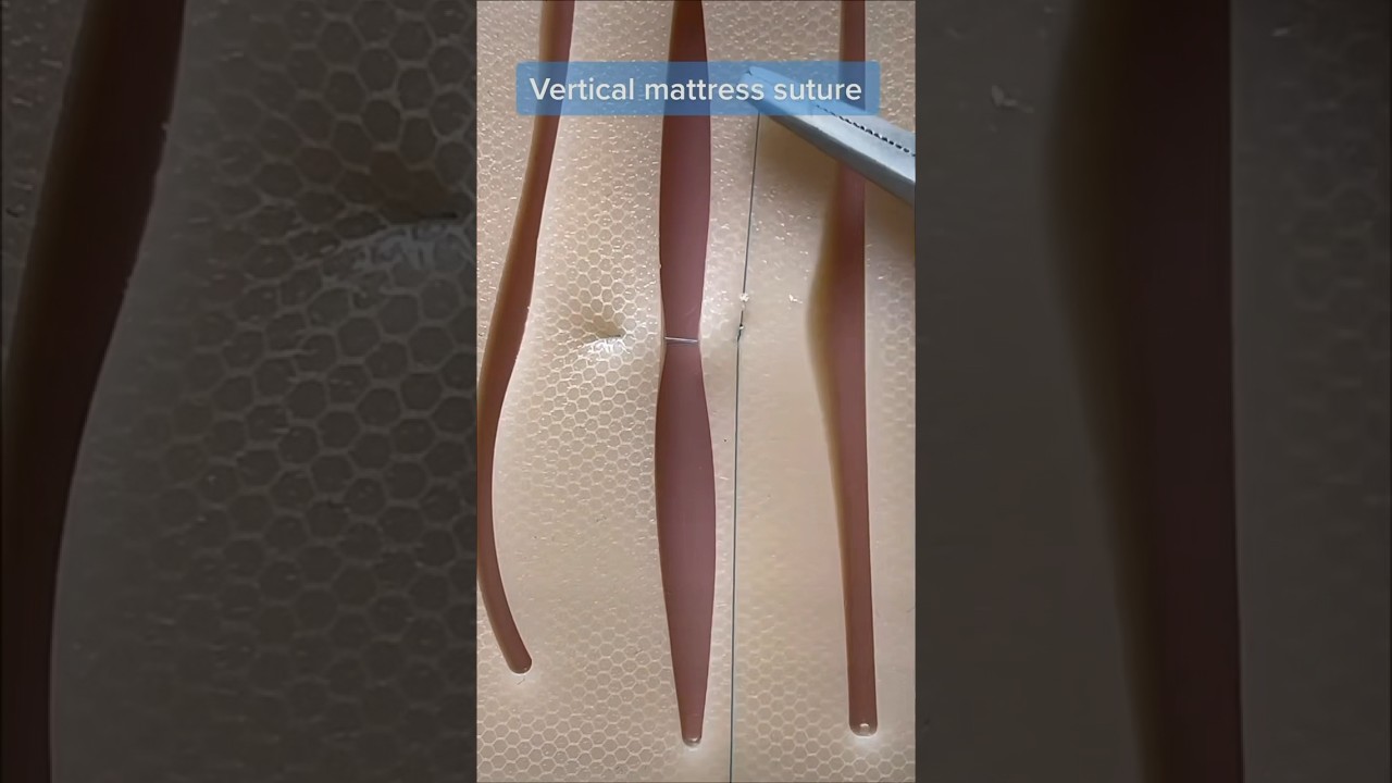 Let&rsquo;s test the pad resistance suturing a high-tension wound (vertical mattress suture)