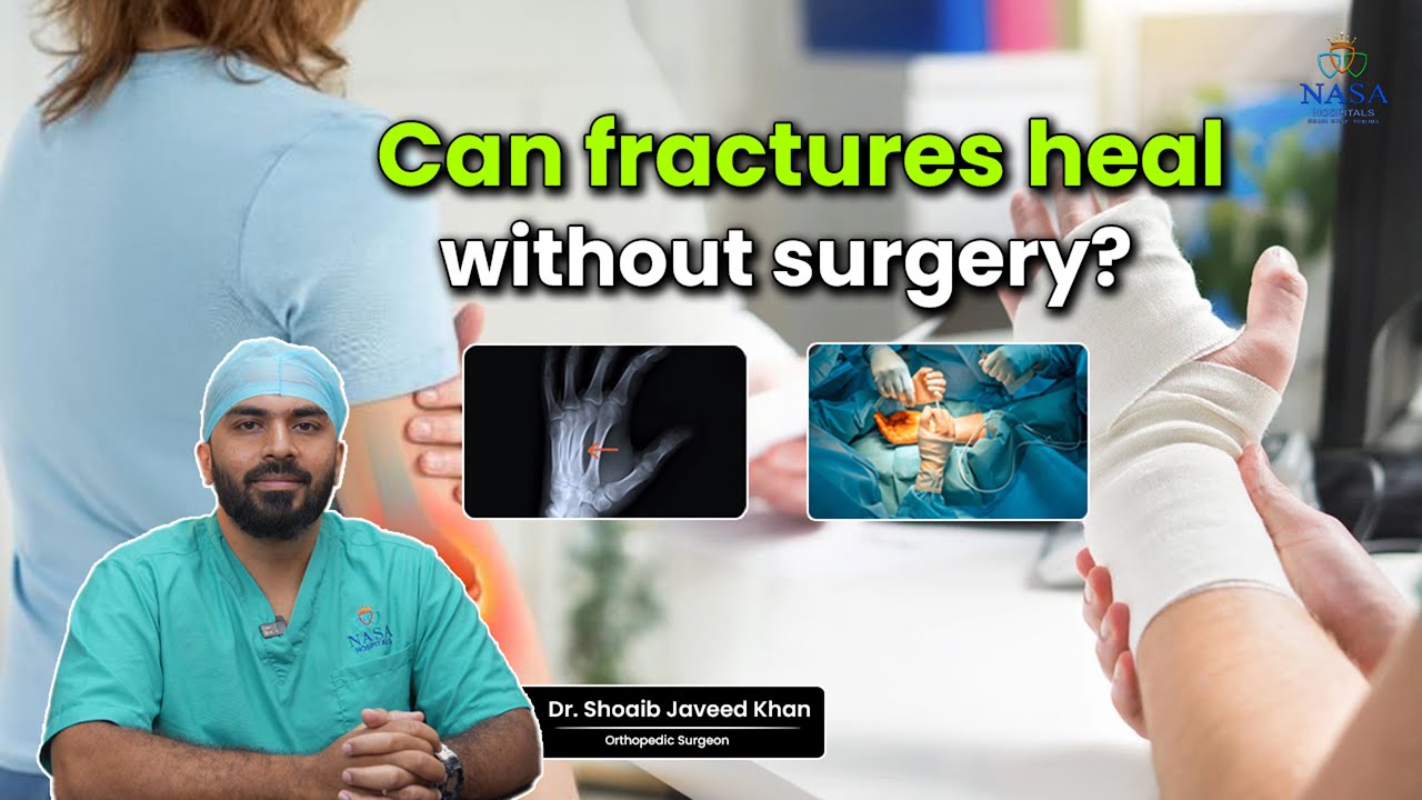 Can Fractures Heal Without Surgery? Expert Orthopedic Advice | Nasa Hospitals Bangalore