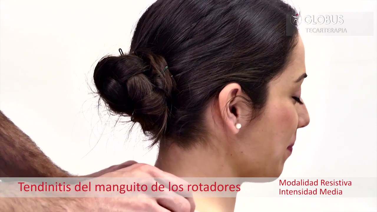 Diatermia: Tratamiento de la tendinitis del manguito de los rotadores con el equipo DiaCare 5000