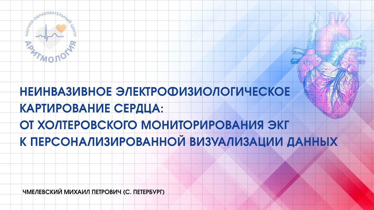 Неинвазивное ЭКГ картирование сердца: от ХМ ЭКГ к персонализированной визуализации данных
