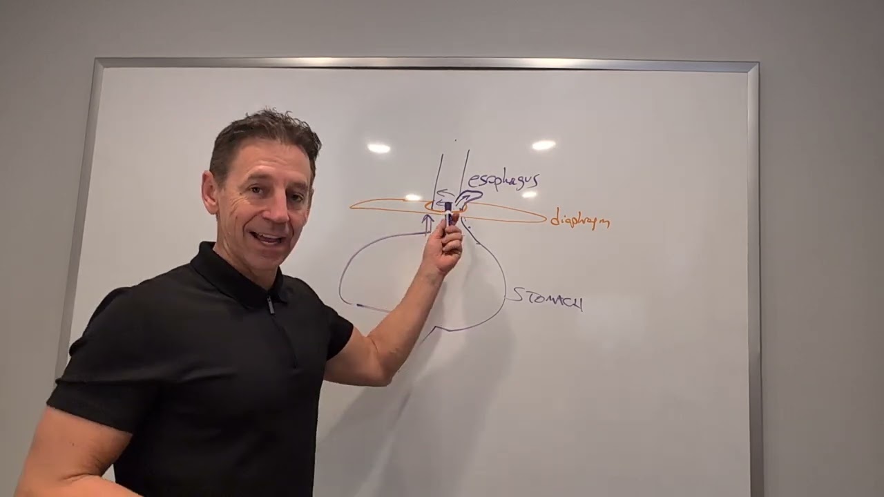 Do You Know If You Have a Hiatal Hernia and Is It Causing Your Heartburn?