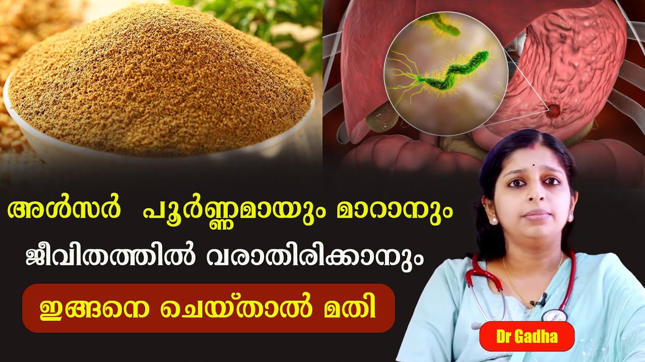 അൾസർ  പൂർണ്ണമായും മാറാനും ജീവിതത്തിൽ വരാതിരിക്കാനും ഇങ്ങനെ ചെയ്താൽ മതി /Dr Gadha