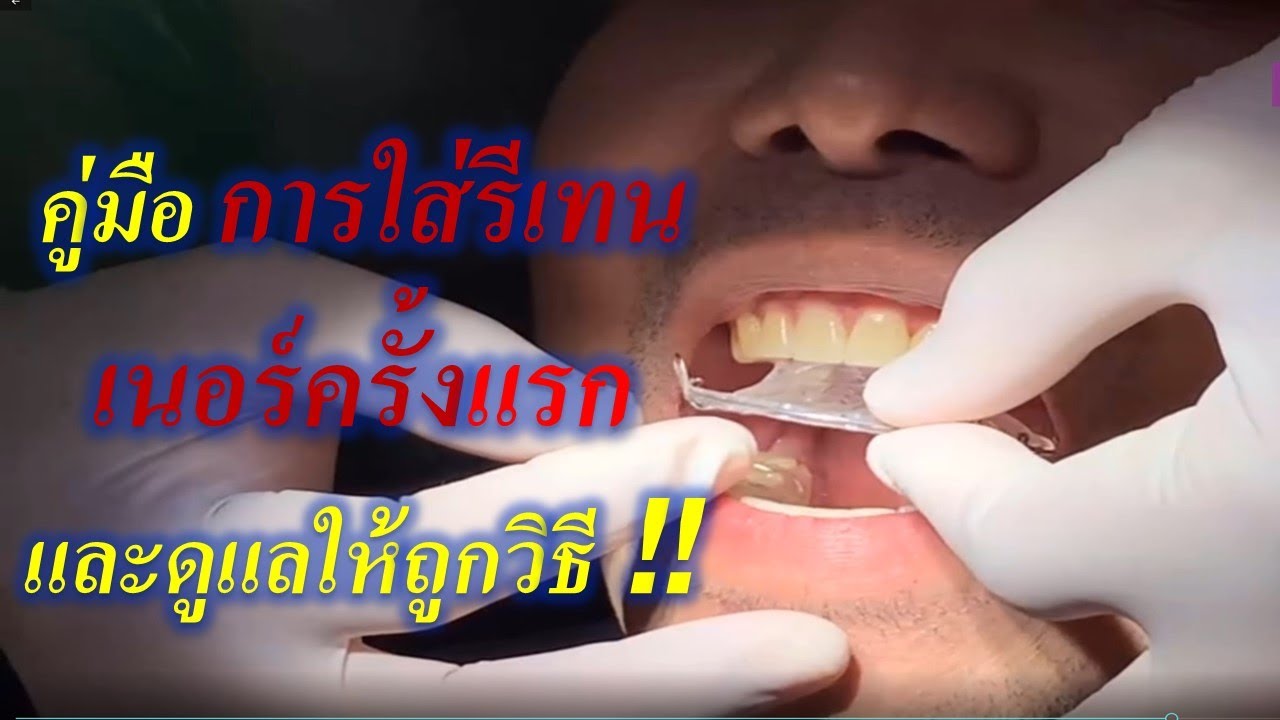 วิธีการใส่รีเทนเนอร์ครั้งแรกให้ถูกต้อง #จัดฟันที่ไหนดี #จัดฟันครั้งแรก #จัดฟัน #จัดฟันรอบสอง 