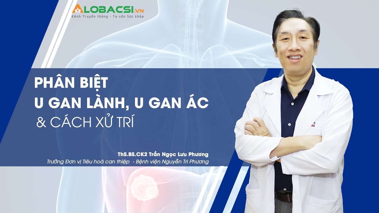 Phân biệt u gan lành tính, u gan ác tính và cách xử trí