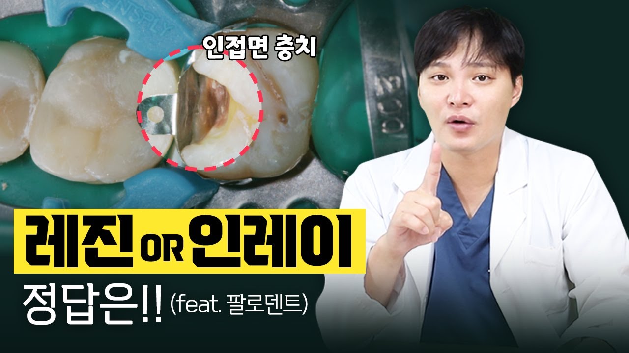 충치치료 하기 전 보고 가세요(feat.팔로덴트)