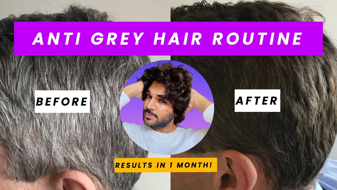 Premature Grey Hair ? How to Reverse Grey Hair Naturally | Suraj Mathkar