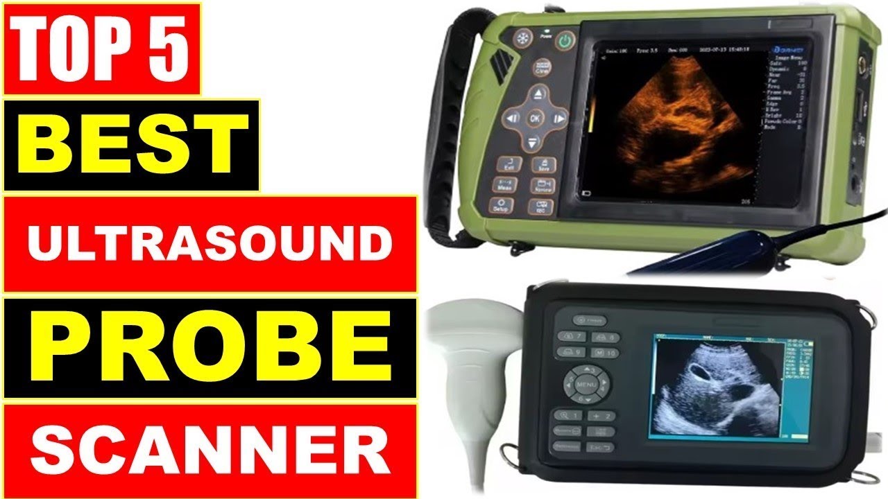BEST Ultrasound Probe Scanner, Top 5 Best Portable Veterinary Ultrasound Scanner On Aliexpress