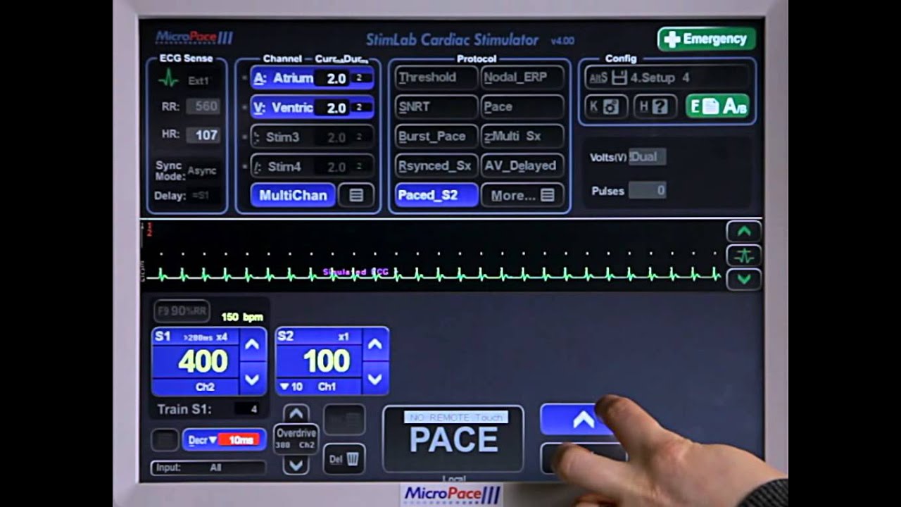 5B - Advanced Pacing - Advanced Protocols