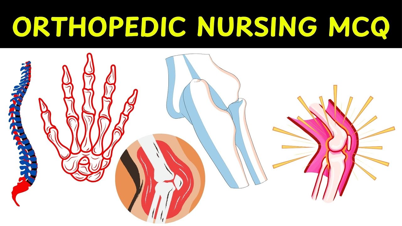 ORTHOPEDIC NURSING MCQ  | Practice MCQs QUIZ with Rationale ANSWERS |