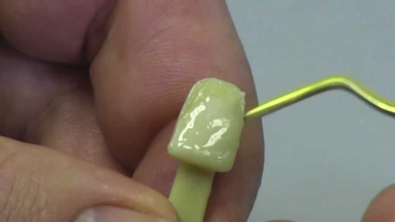 Composite Restoration - How to avoid air bubbles
