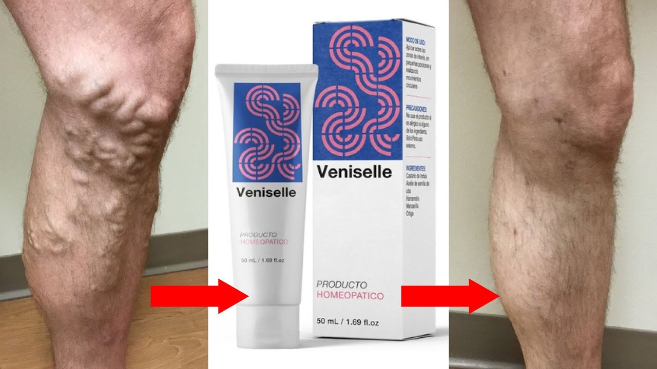 Best Medicine for Varicose Vein || Varicose Vein Treatment Medicine Veniselle
