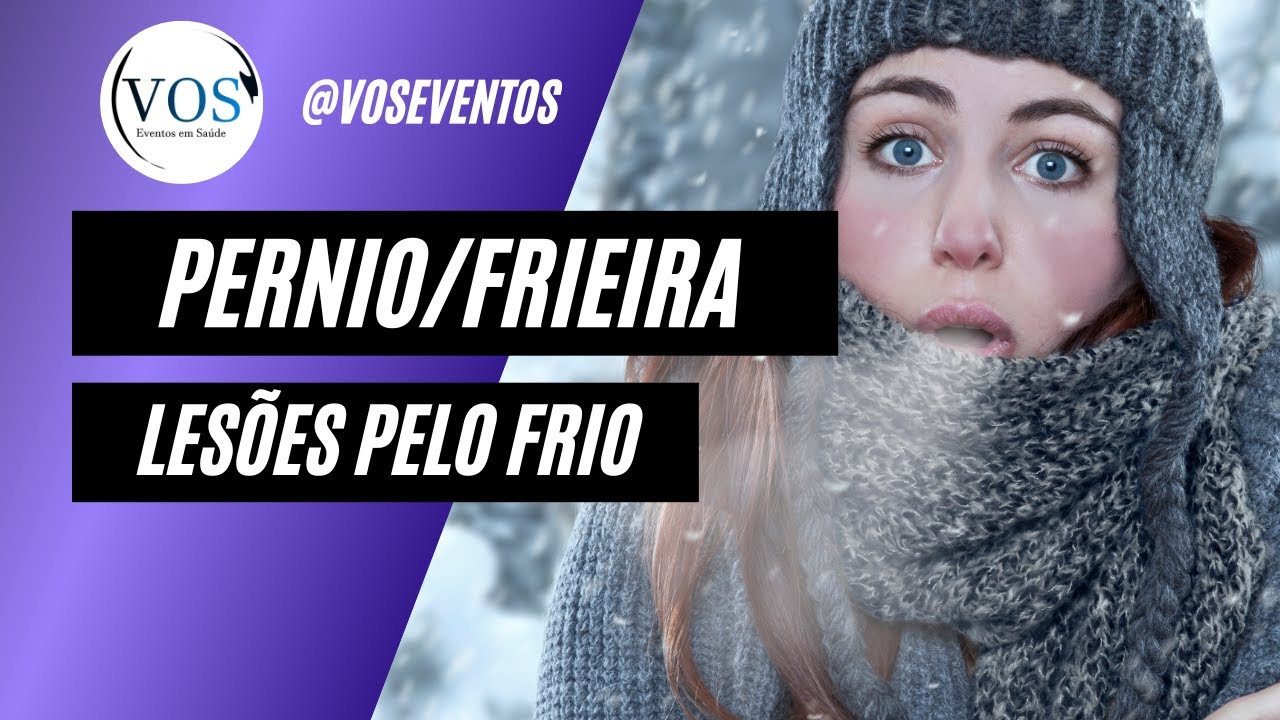 Pernio/Frieira | Lesões pelo frio