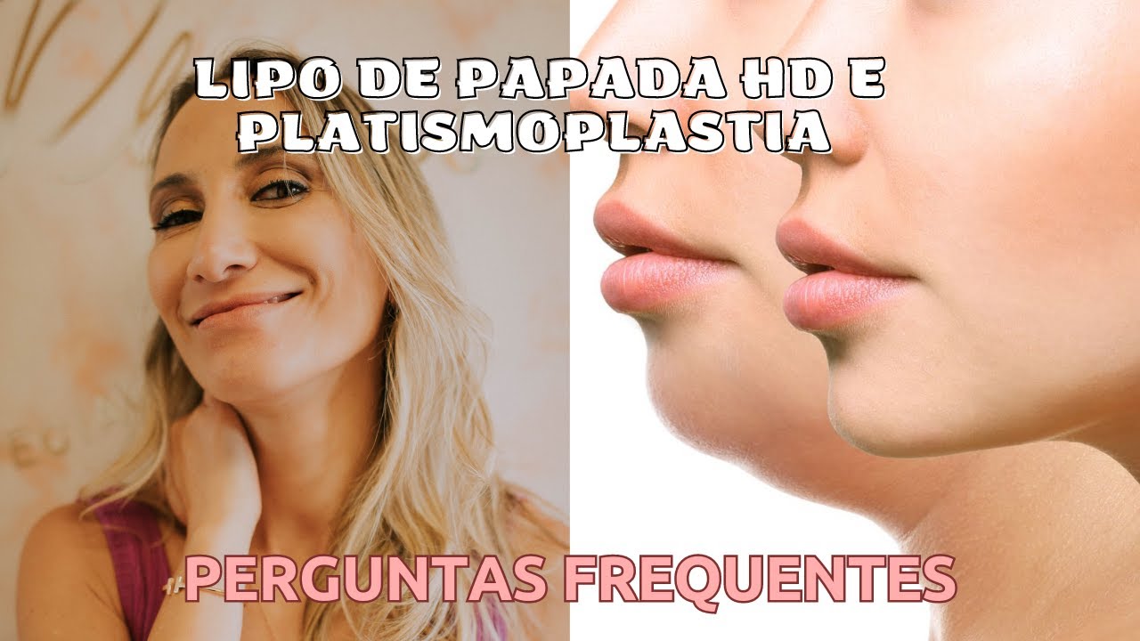 Perguntas frequentes Lipo de Papada e Platismoplastia