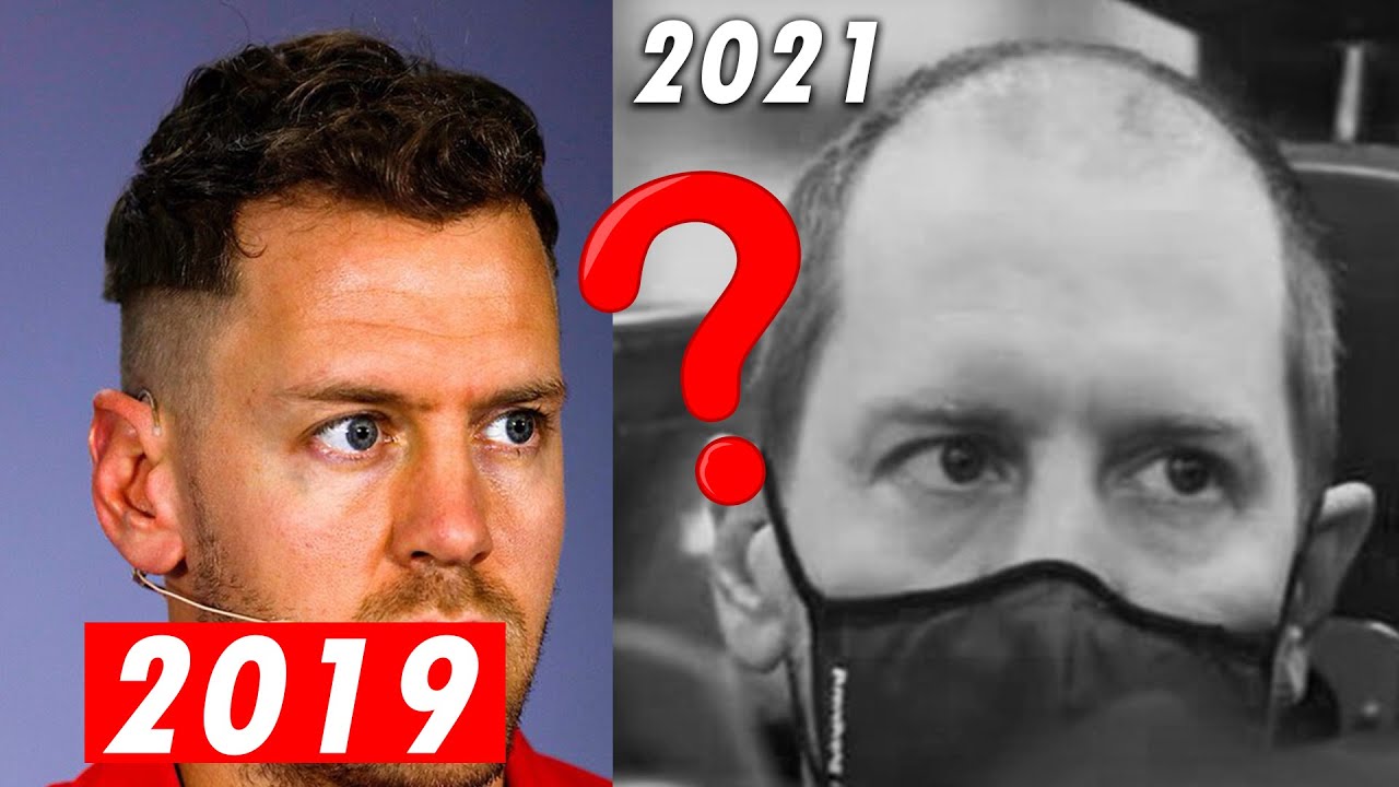 Sebastian Vettel's Rapid Hair Loss! WTF Happened? NW2 - NW5 in 2 years