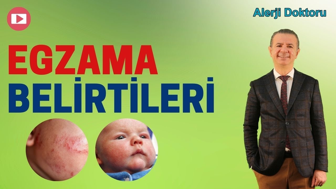 Egzama Belirtileri - Prof. Dr. Ahmet Akçay