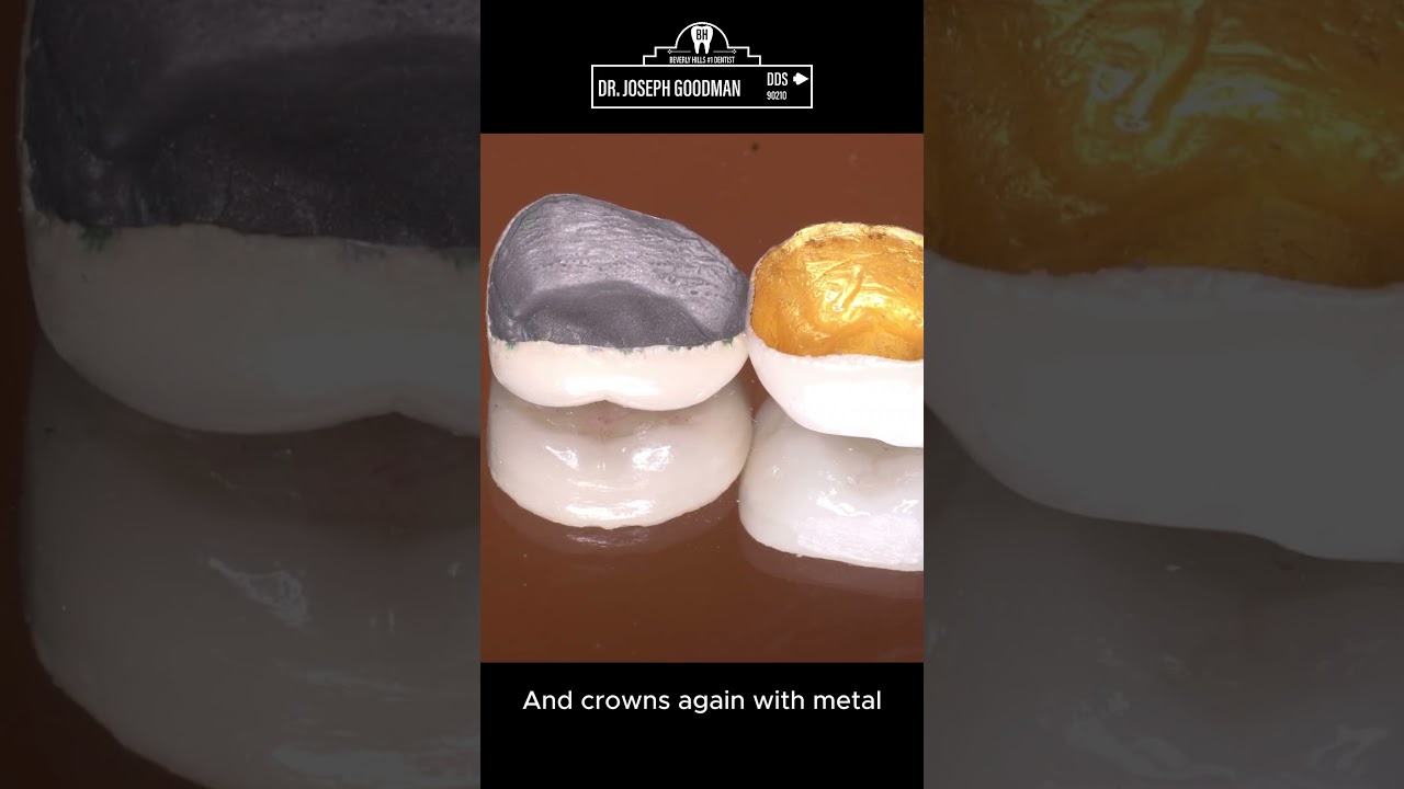 Veneers vs Crowns: Why Top Beverly Hills Dentist Prefers Veneers Over Crowns | Dr. Joseph Goodman