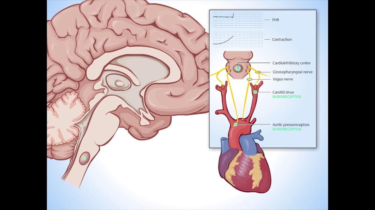 Variable Decelerations - Fundamentals of Fetal Health Survelliance