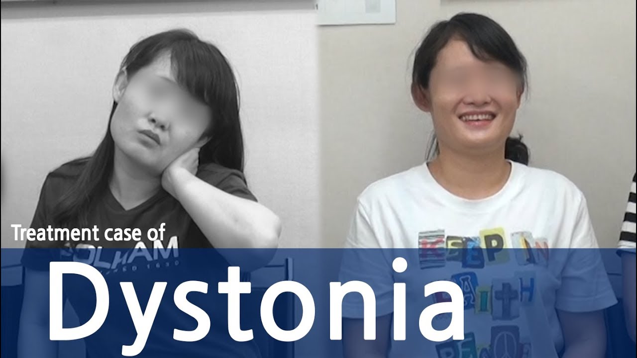 Cervical Dystonia /Dystonia/ Spasmodic Torticollis / 사경증 치료사례 / 근긴장이상증